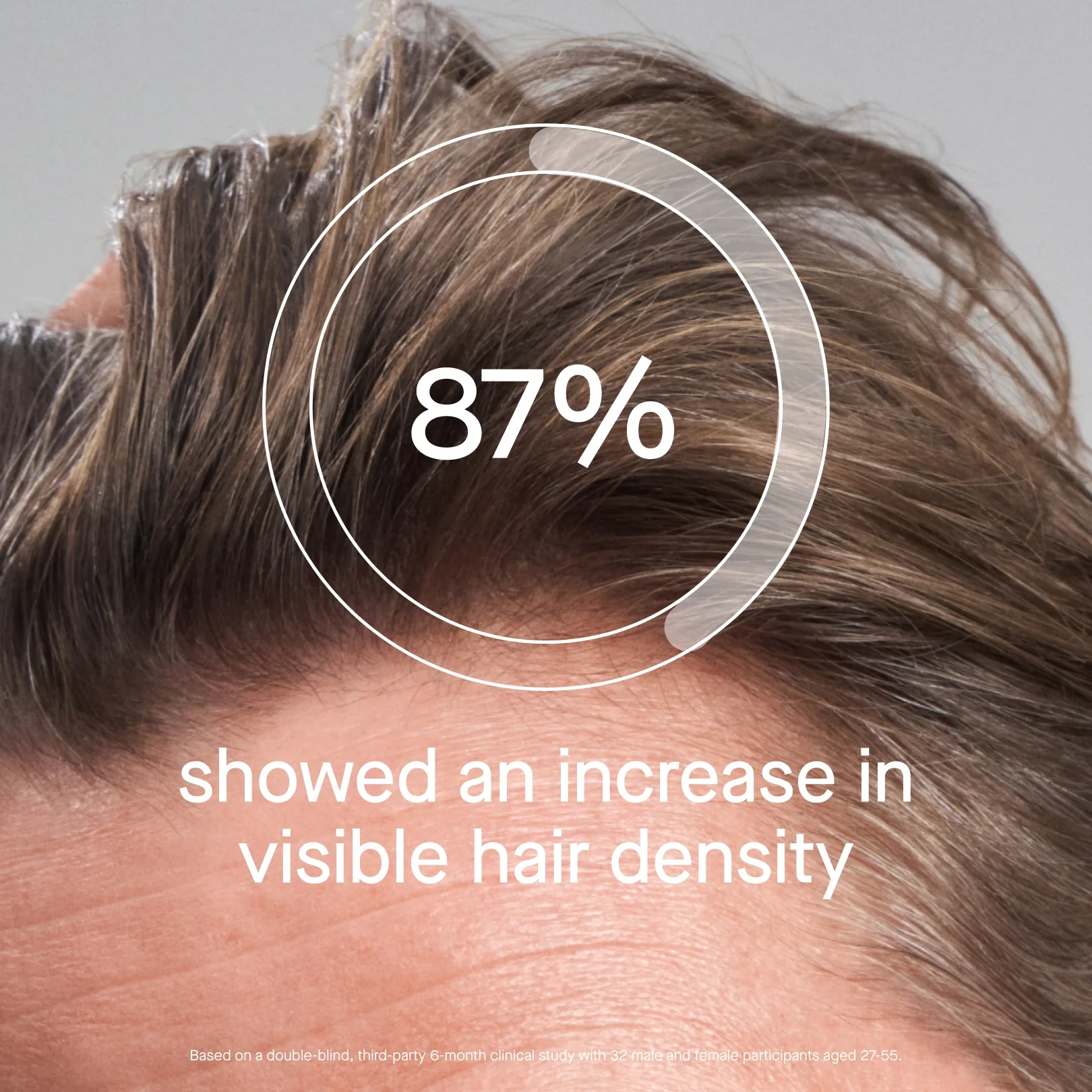 OS-01 HAIR SCALP SERUM - Image 4