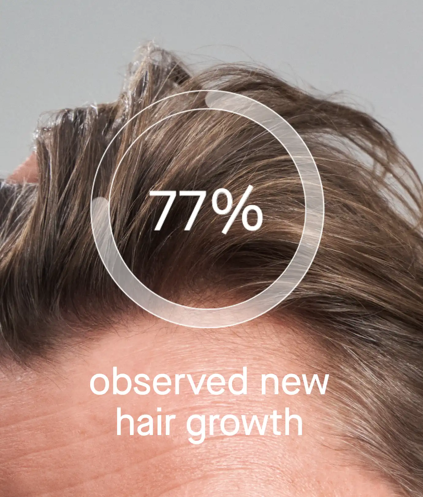 OS-01 HAIR - Image 6
