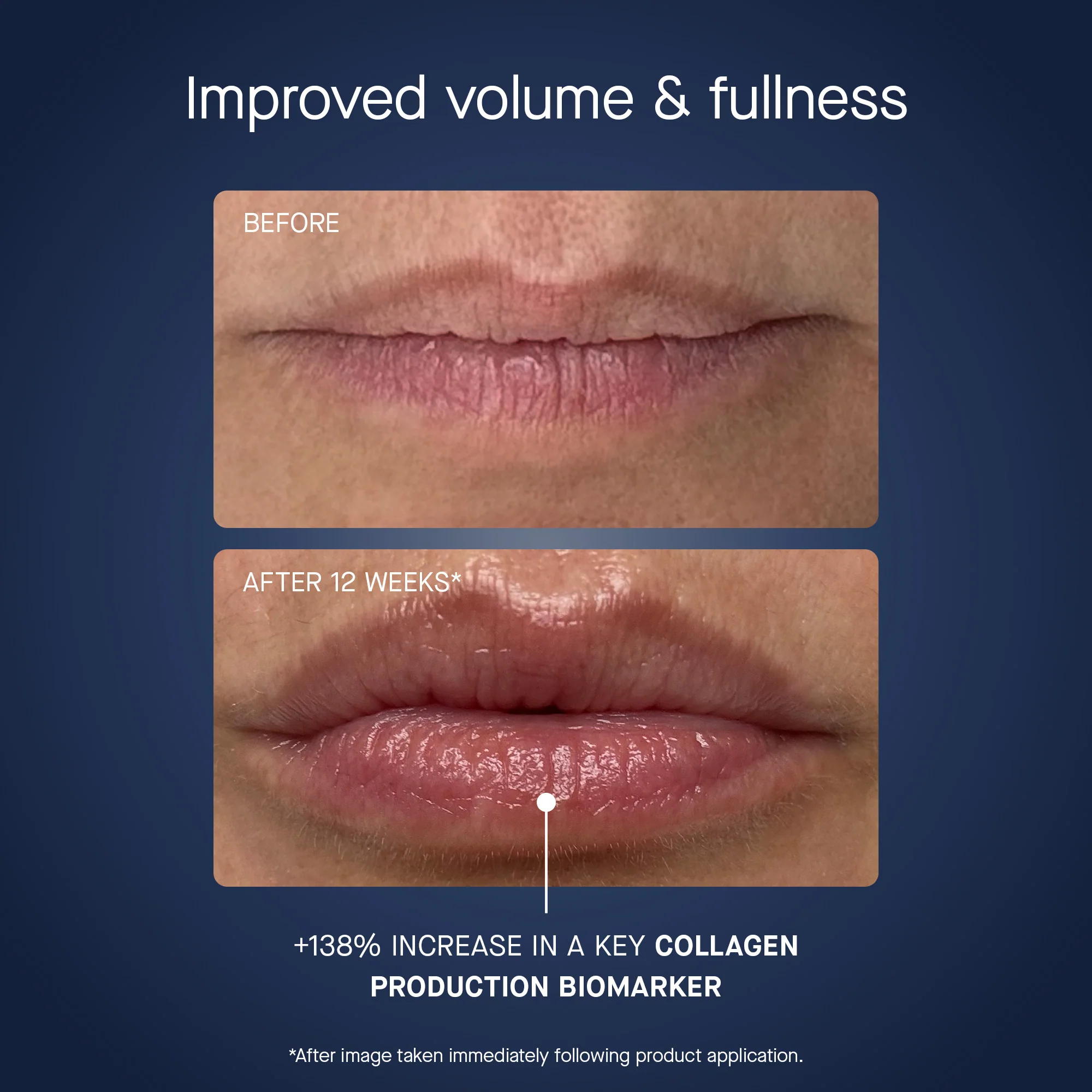 OS-01 LIP RESTORE MASK - Image 3